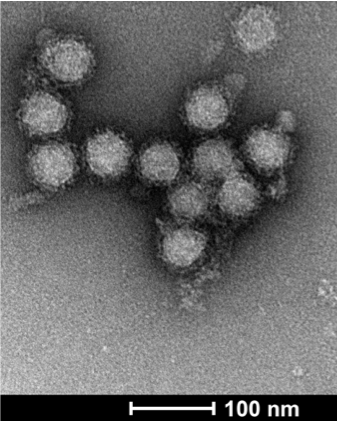 Electron Micrograph Chikungunya Antanasijevic
